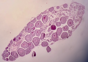 A histology image of a gonad showing oocytes